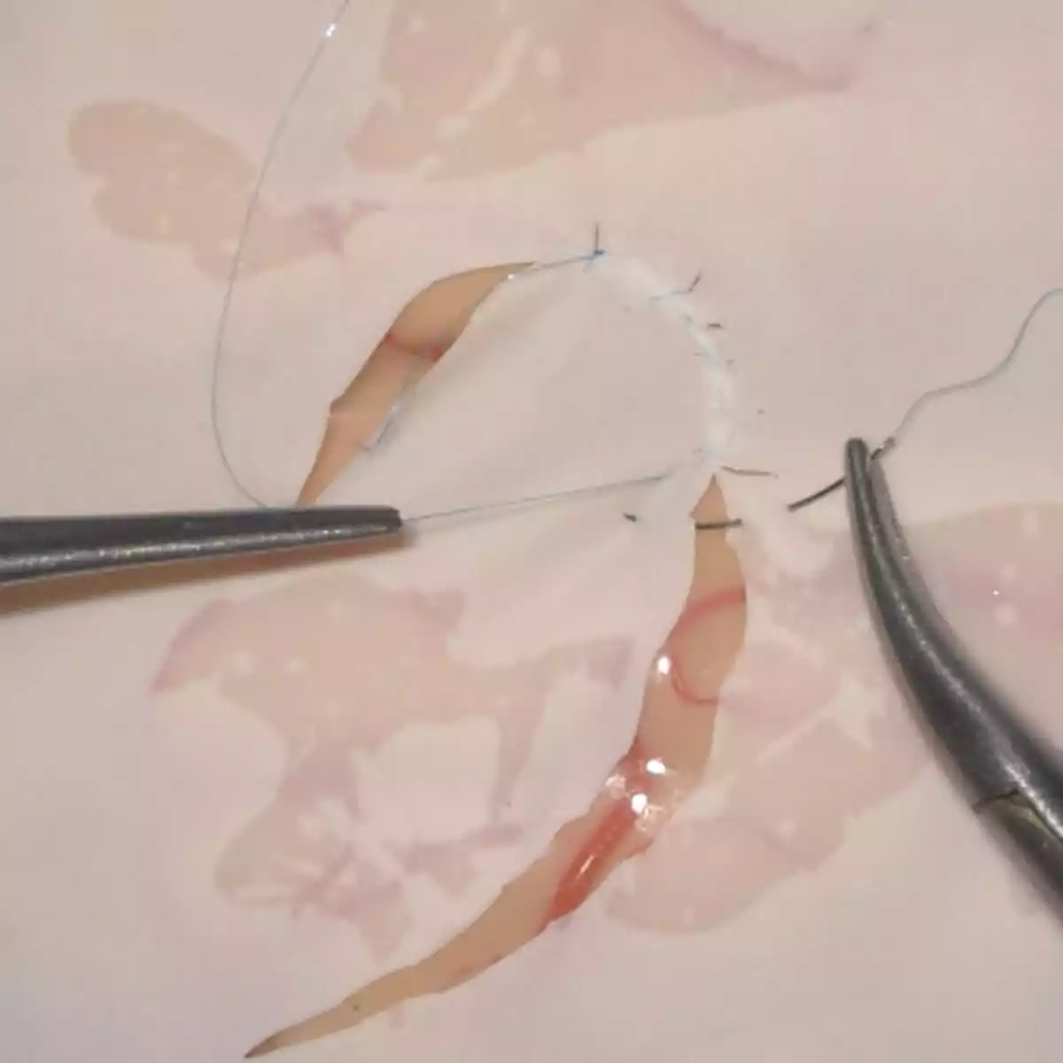  Système d'entraînement Mycro pour anastomoses microvasculaires & microsutures