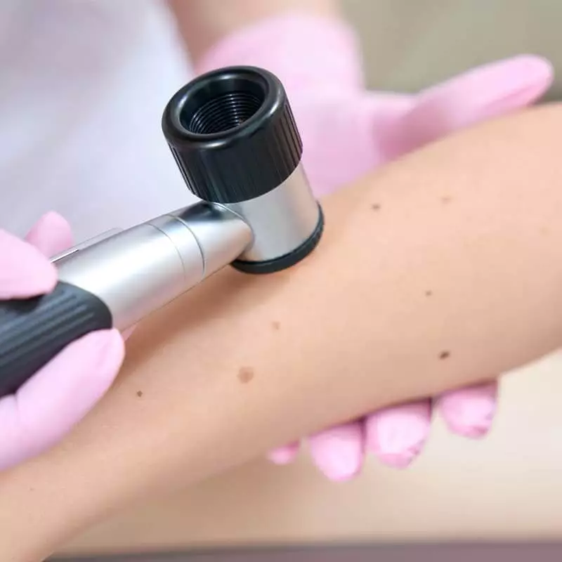 Kategorie 800x800 Dermatoskopie