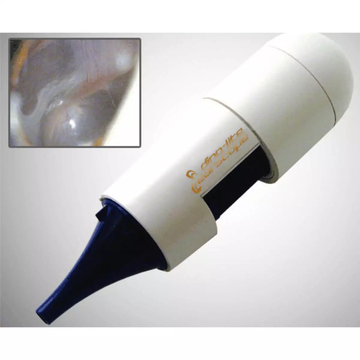  Otoscope vidéo sans fil EarScope Pro