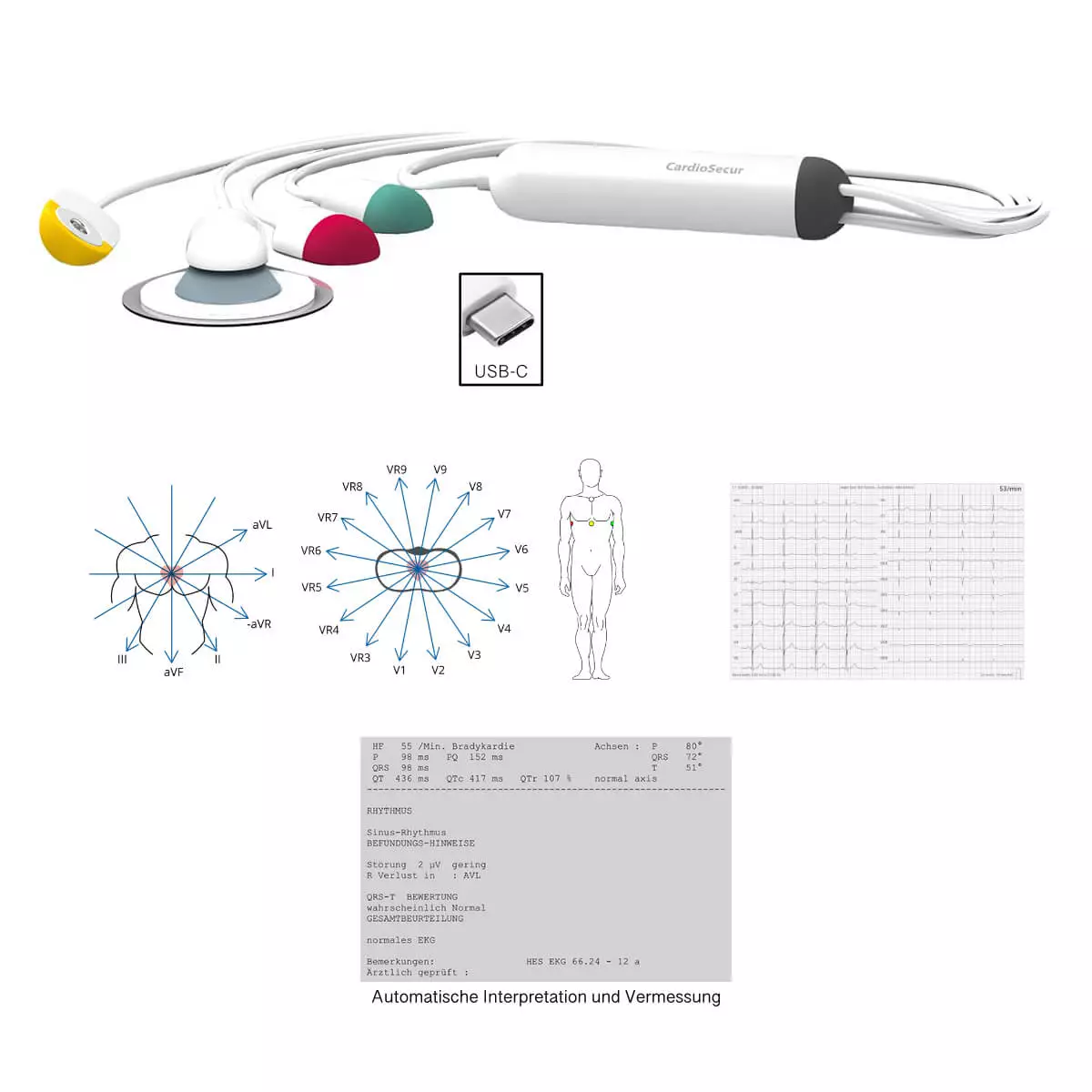  Système ECG CardioSecur Pro