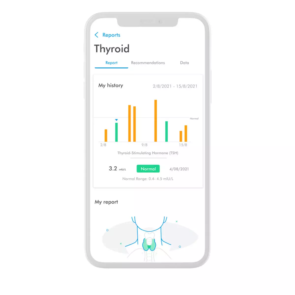Test thyroïdien de Bloom Test thyroïdien de Bloom