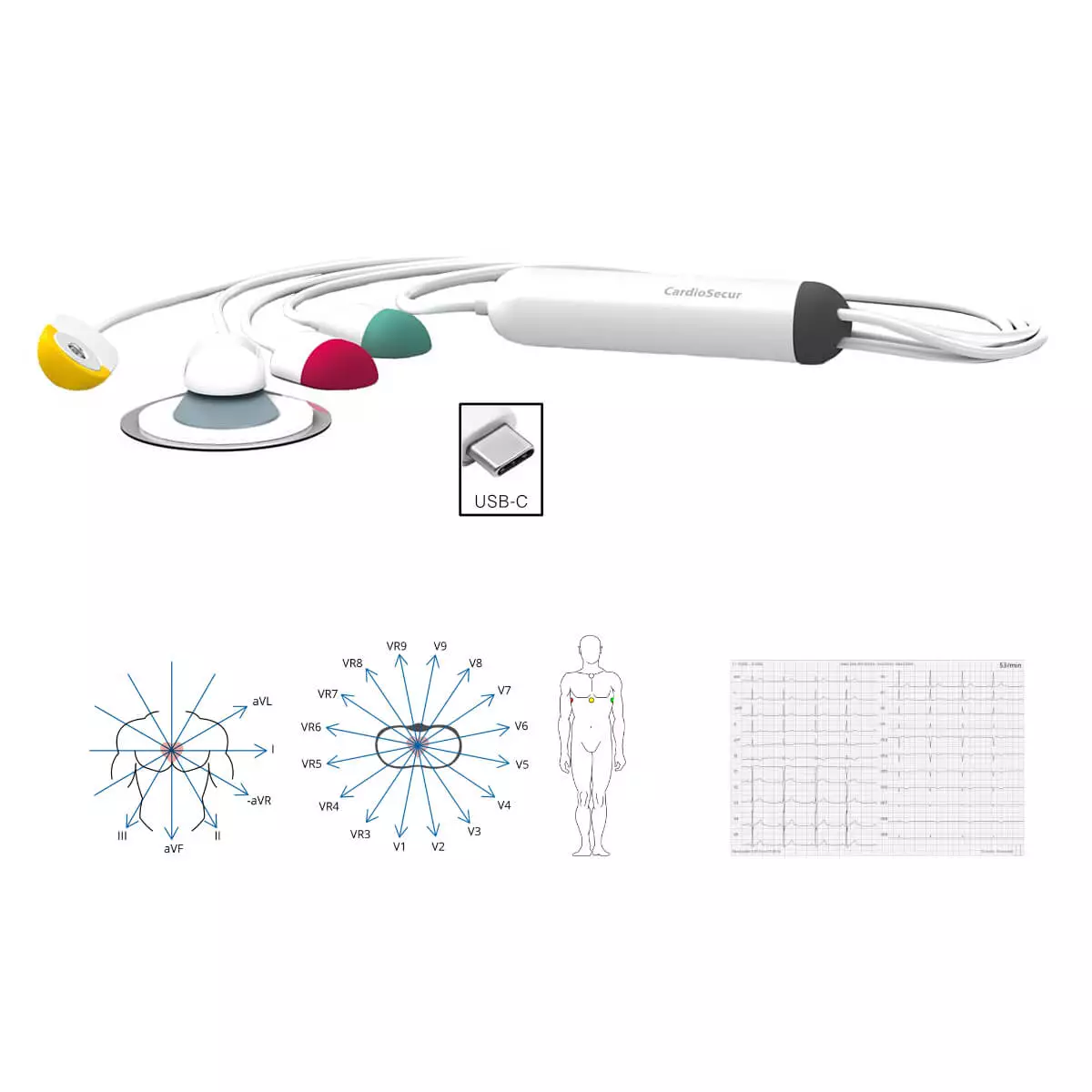 Système ECG CardioSecur Pro Système ECG CardioSecur Pro