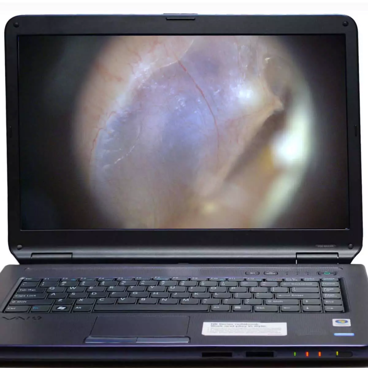  Otoscope vidéo sans fil EarScope Pro