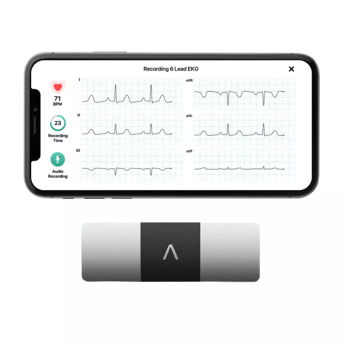  ECG 6 pistes KardiaMobile® 6L