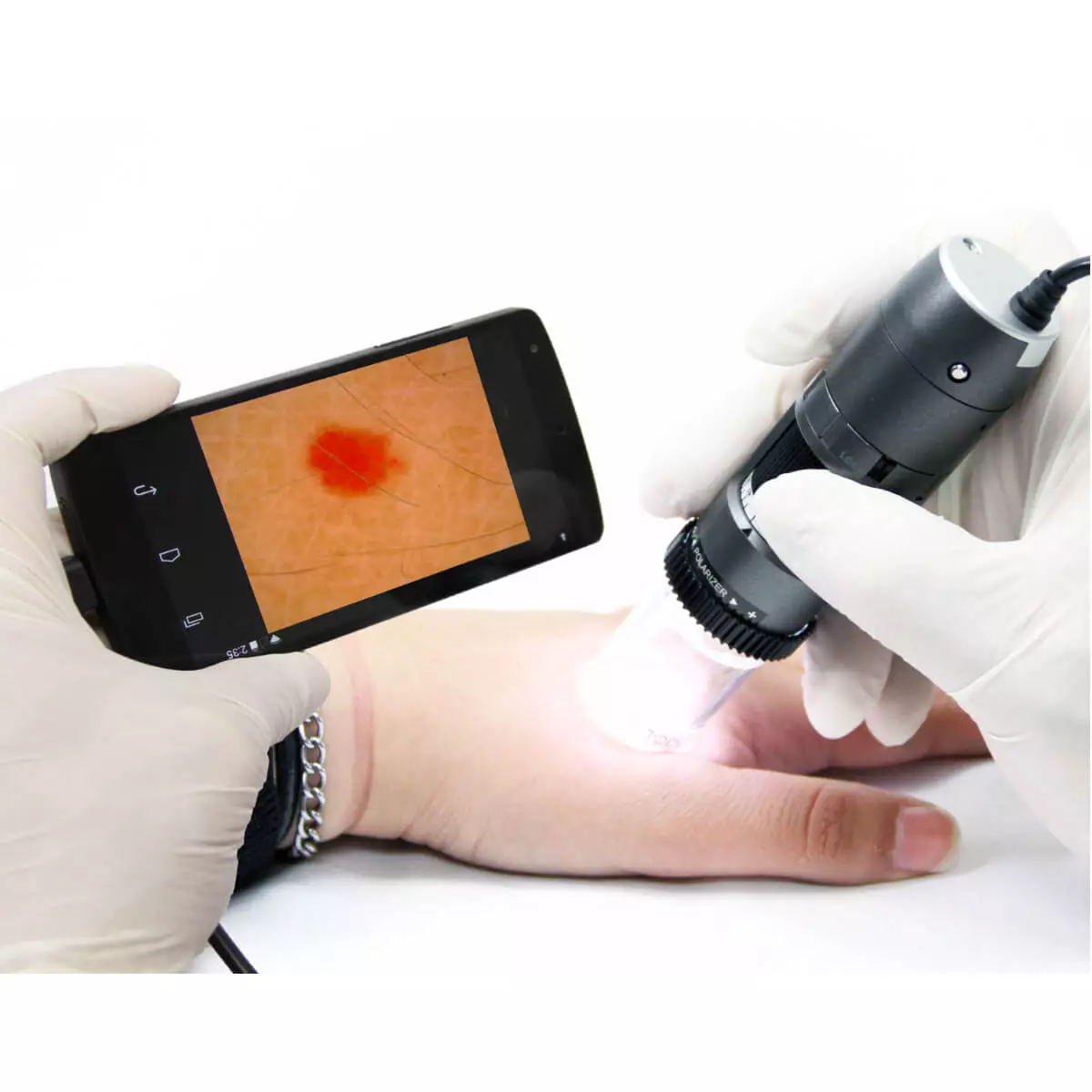  Dermatoscope vidéo DermaScope Polarizer HR 200x
