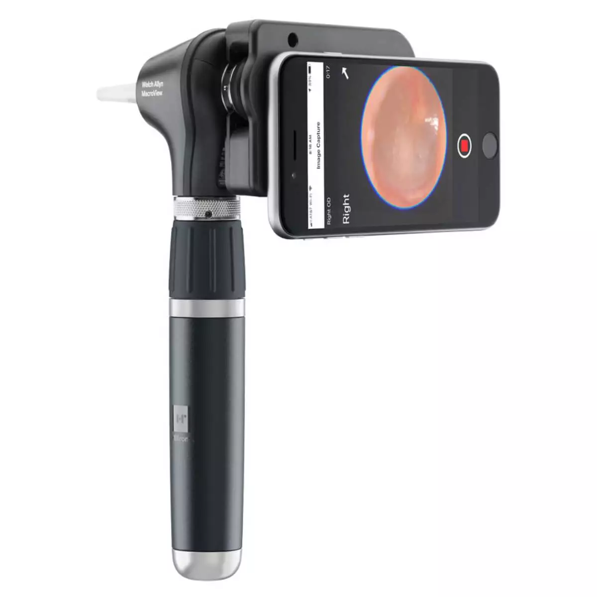 Kit de diagnostic avec otoscope MacroView Plus et kit iExaminer Kit de diagnostic avec otoscope MacroView Plus et kit iExaminer