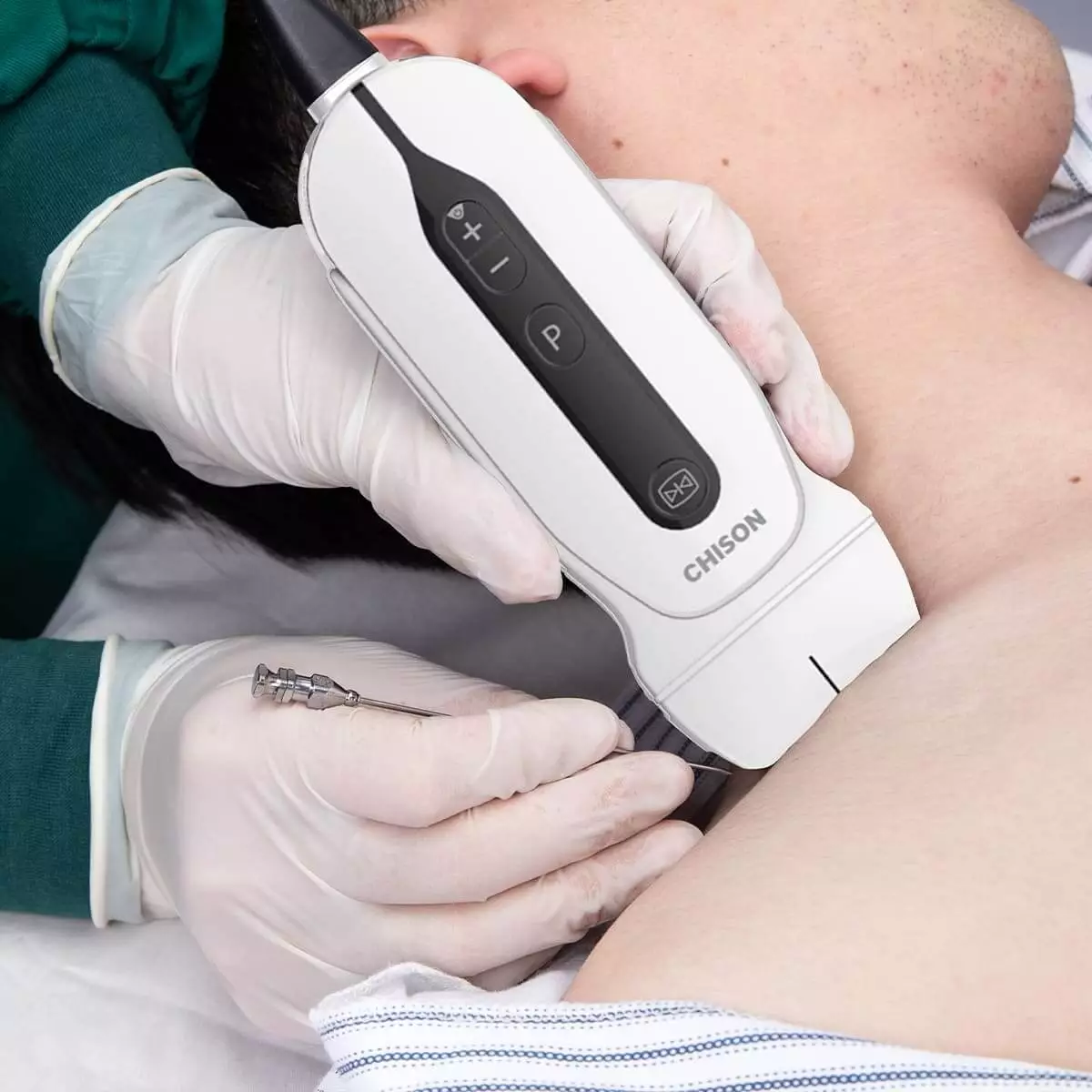  Échographe portable SonoEye G2