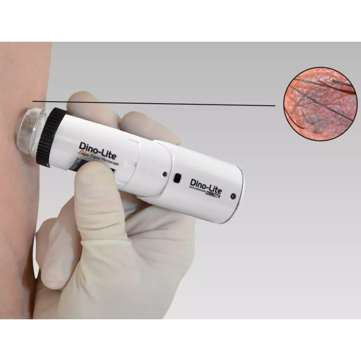  Dermatoscope vidéo sans fil DermaScope Polarizer