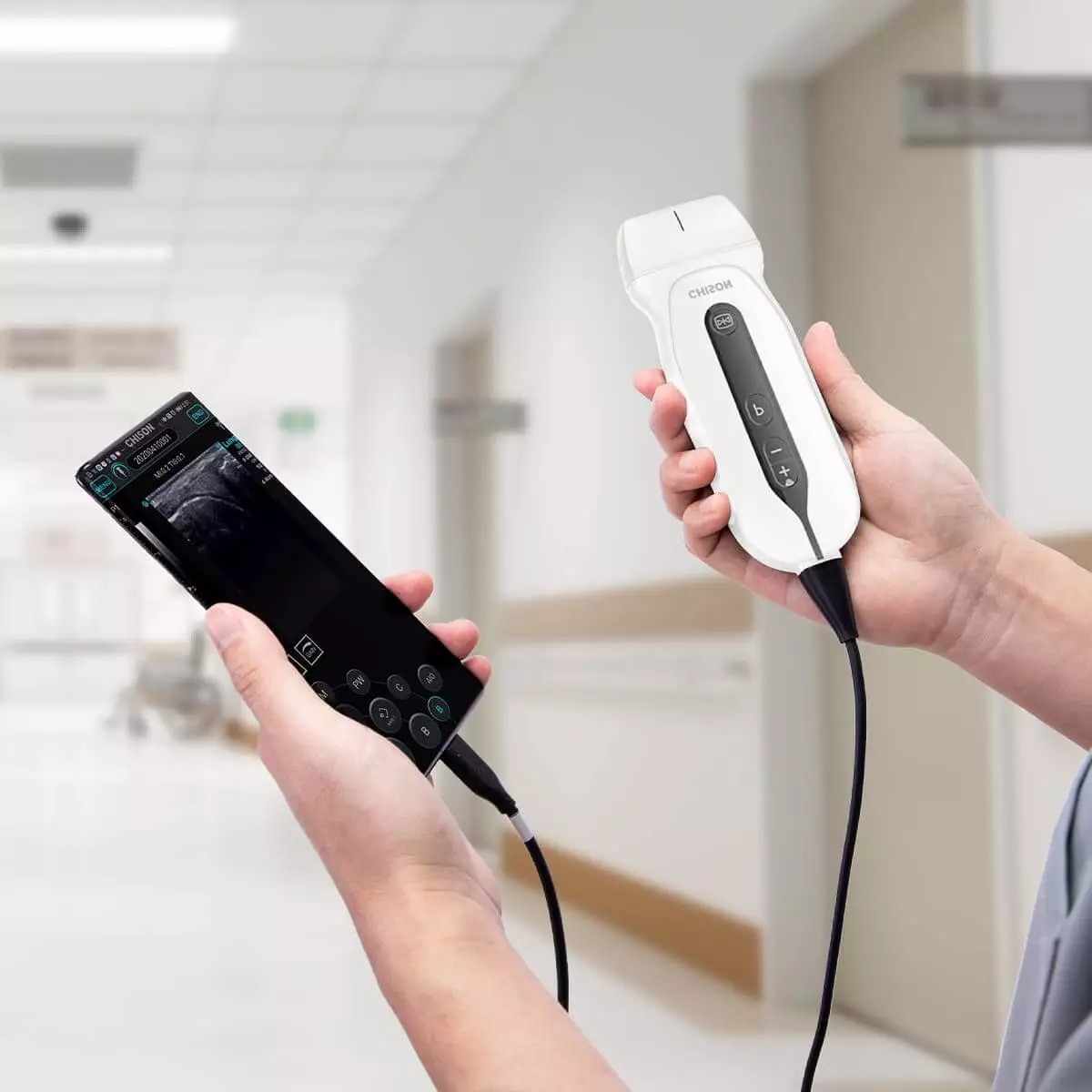  Échographe portable SonoEye G2