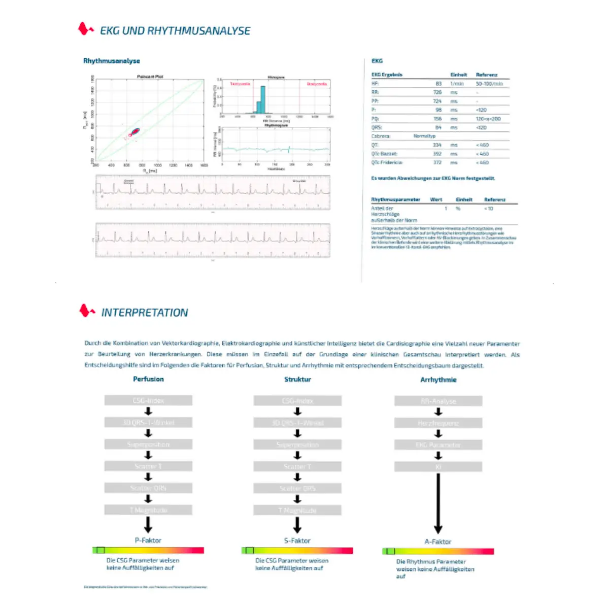 ECG 3D basé sur l'IA Cardisio ECG 3D basé sur l'IA Cardisio
