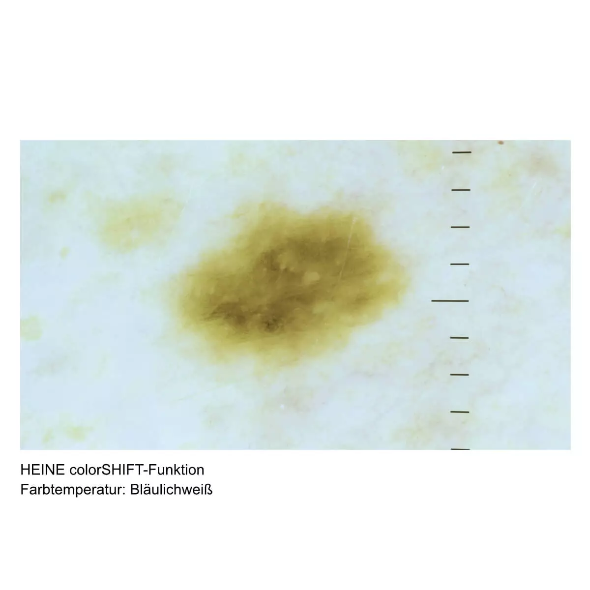  Dermatoscope HEINE DELTA 30 PRO