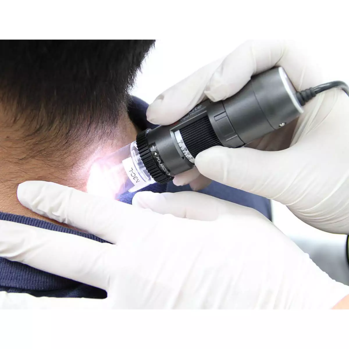  Dermatoscope vidéo DermaScope Polarizer HR 200x