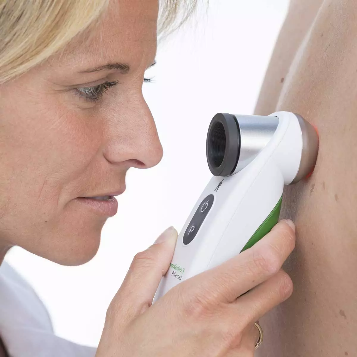  Dermatoscope DermoGenius 3 polarised