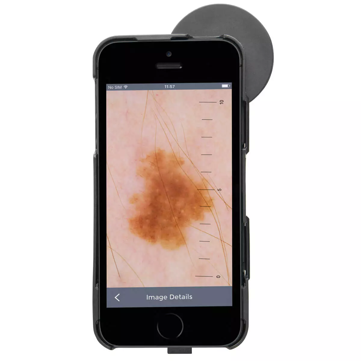  Dermatoscope HEINE iC1