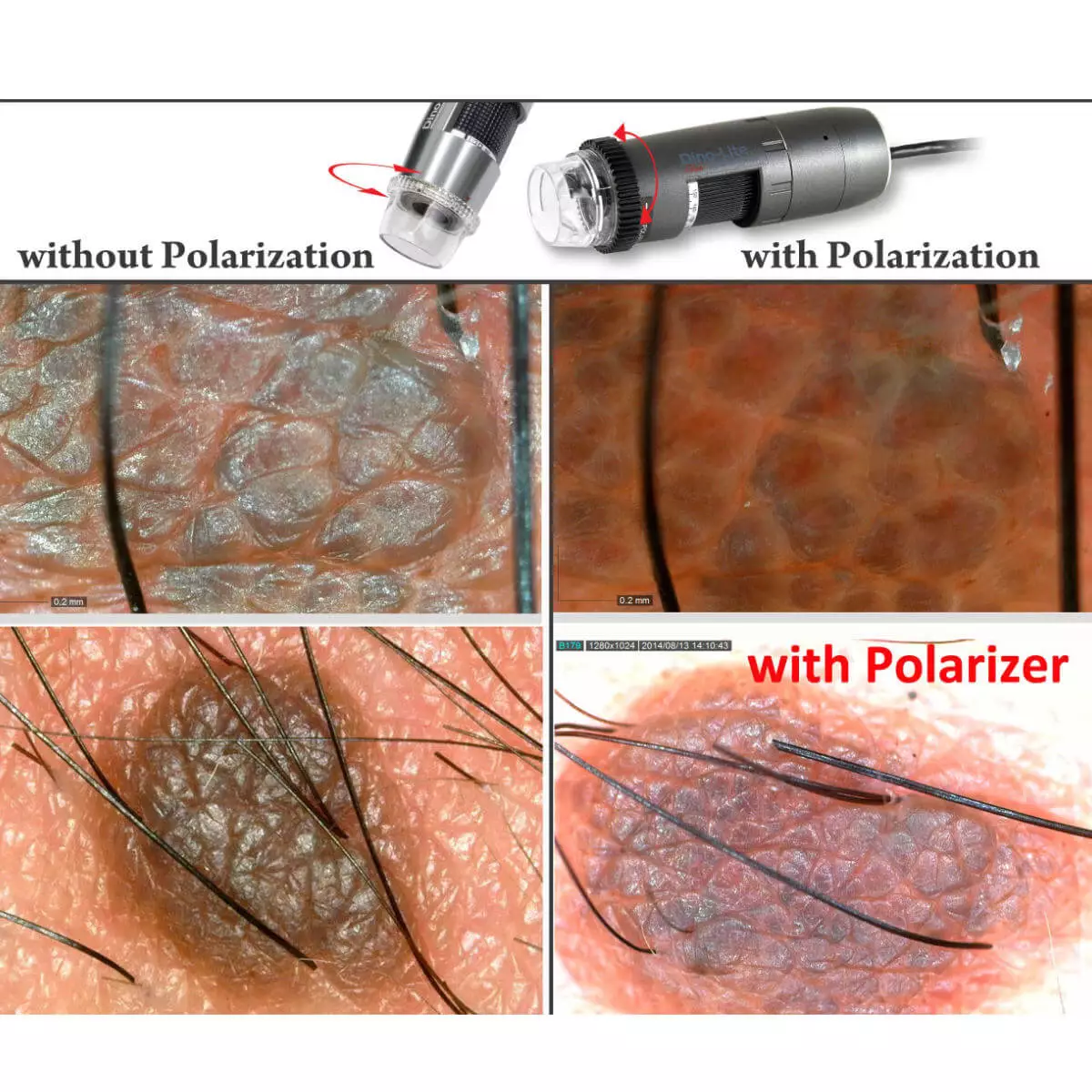  Dermatoscope vidéo DermaScope Polarizer HR 200x