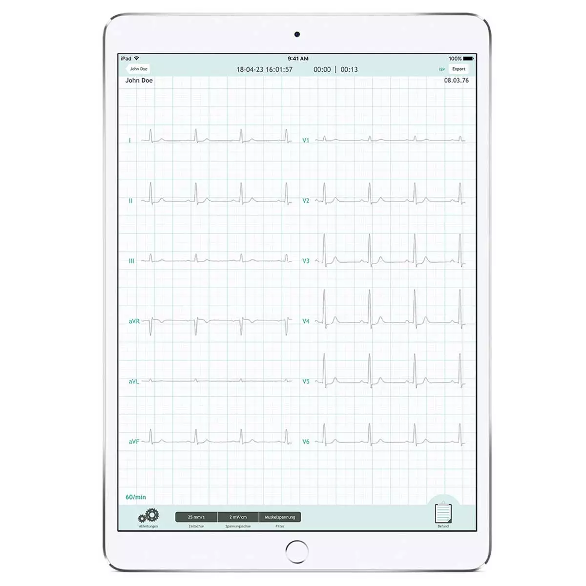  Système ECG CardioSecur Pro