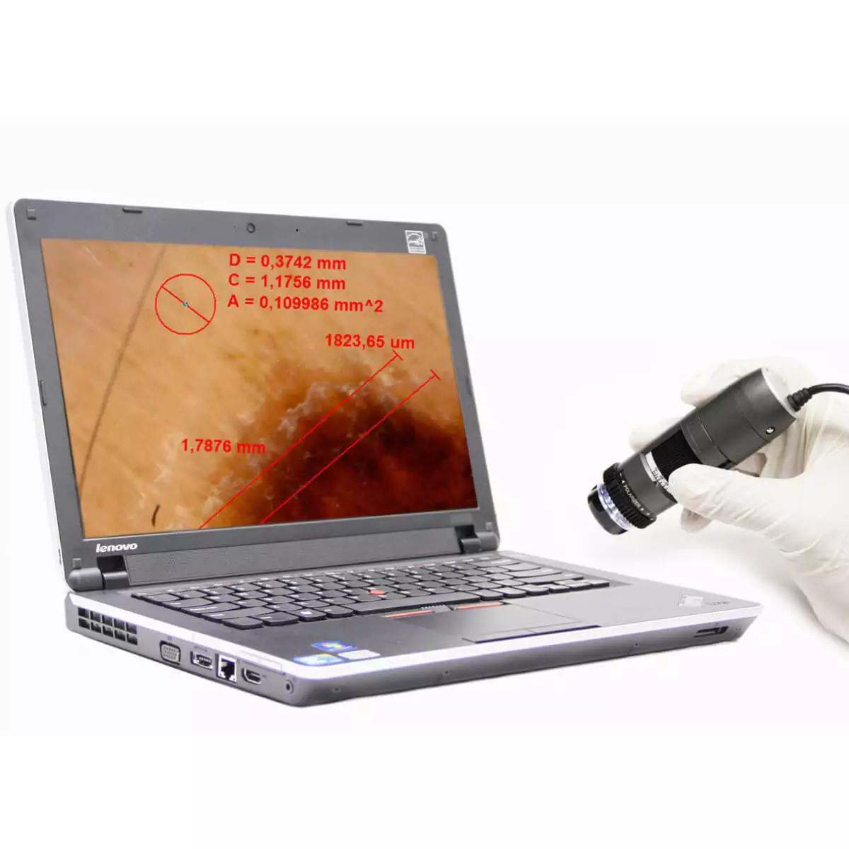  Dermatoscope vidéo DermaScope Polarizer HR 200x
