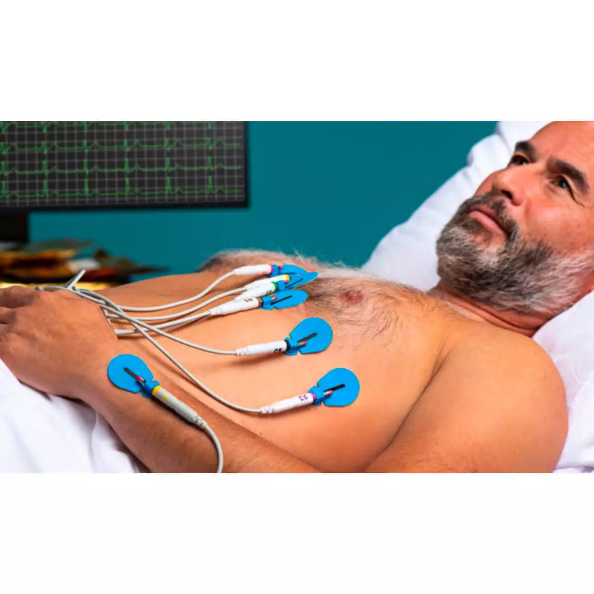  Électrodes ECG à usage unique BlueSensor SU-00-A/60