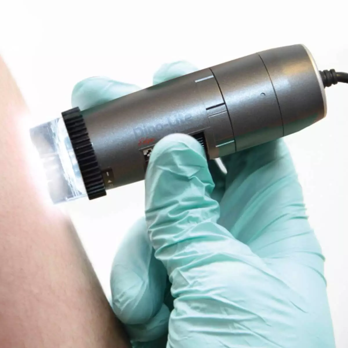  Dermatoscope vidéo DermaScope Polarizer HR 200x