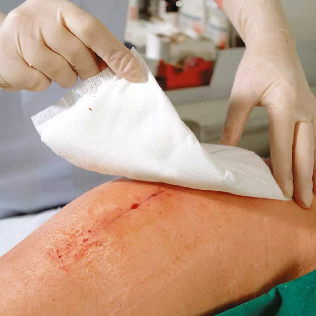  Compresses absorbantes stériles Zetuvit