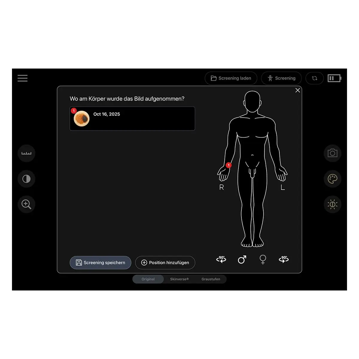  Dermatoscope numérique « Scaut® »