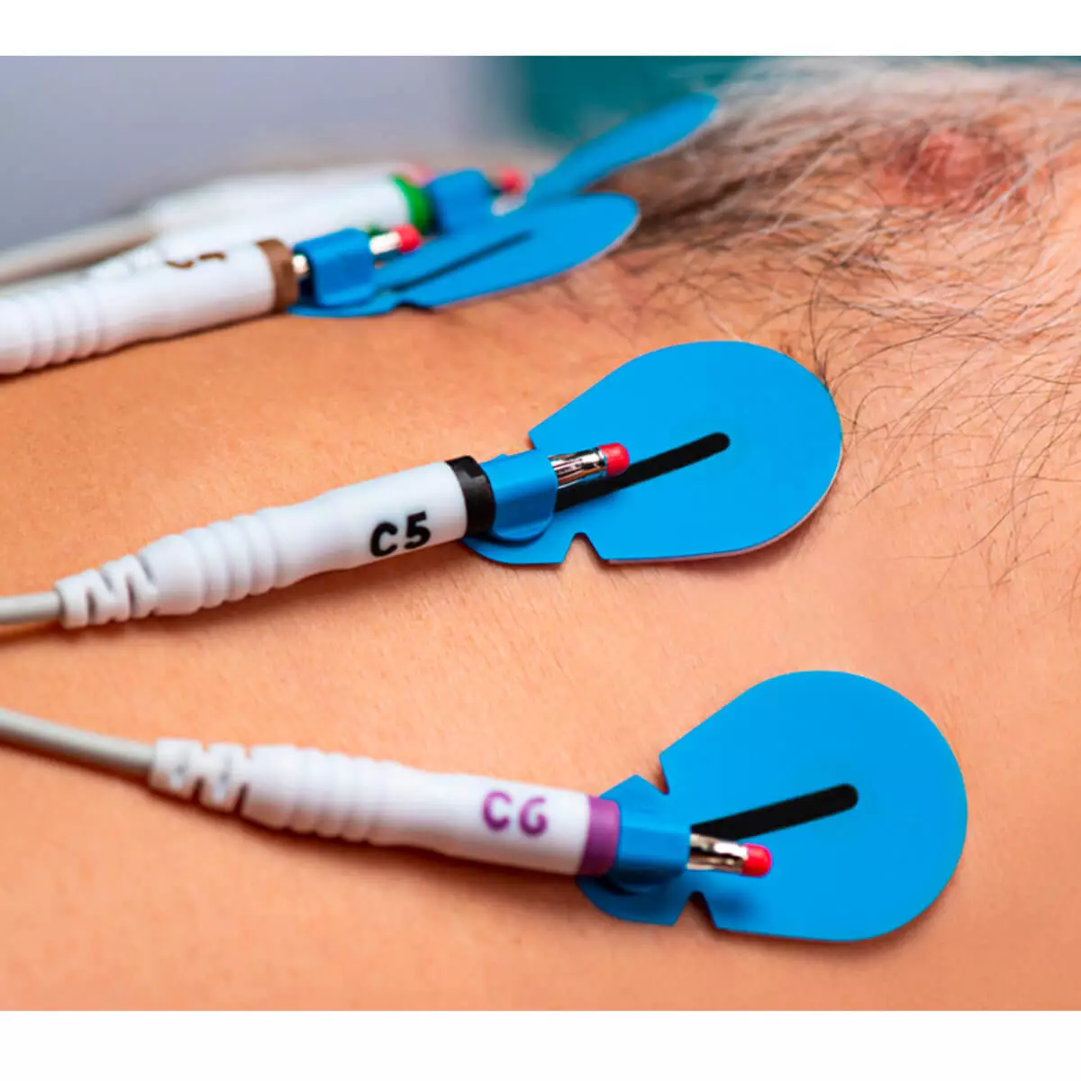  Électrodes ECG à usage unique BlueSensor SU-00-A/60