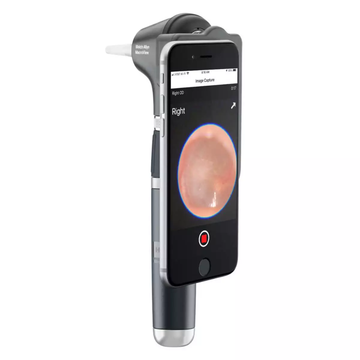 Kit de diagnostic avec otoscope MacroView Plus et kit iExaminer Kit de diagnostic avec otoscope MacroView Plus et kit iExaminer