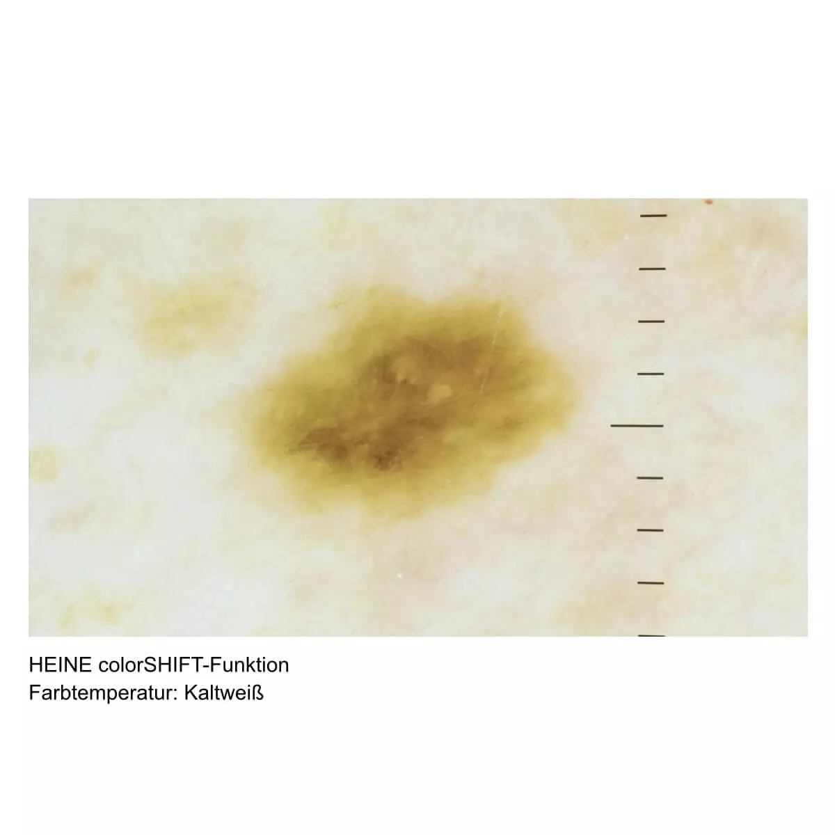  Dermatoscope HEINE DELTA 30 PRO