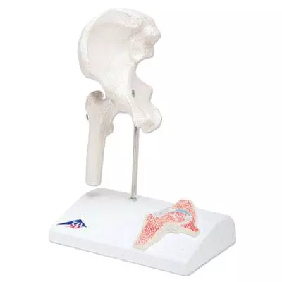  Articulation de la hanche mini