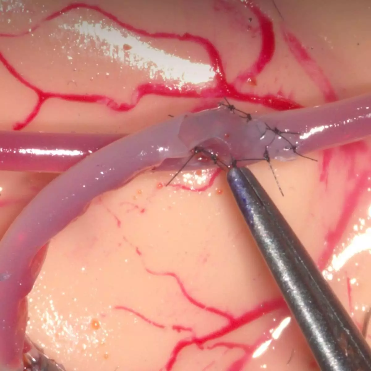  Système d'entraînement Mycro pour anastomoses microvasculaires & microsutures