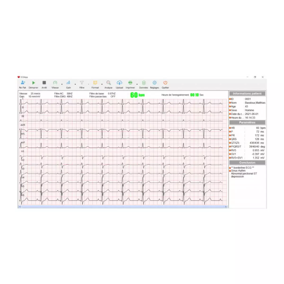  ECG CARDIOMATE PC