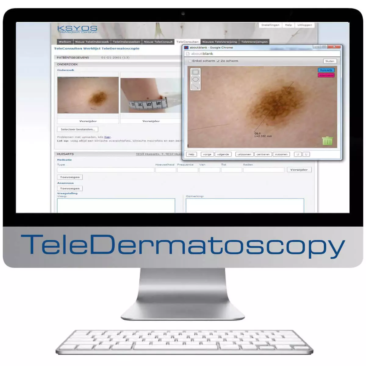  Dermatoscope vidéo DermaScope Polarizer HR 200x