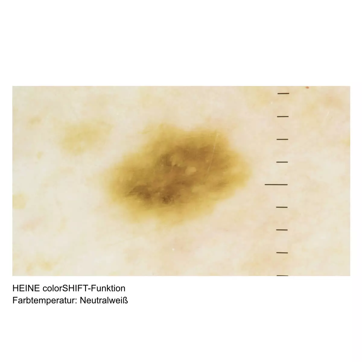  Dermatoscope HEINE DELTA 30 PRO
