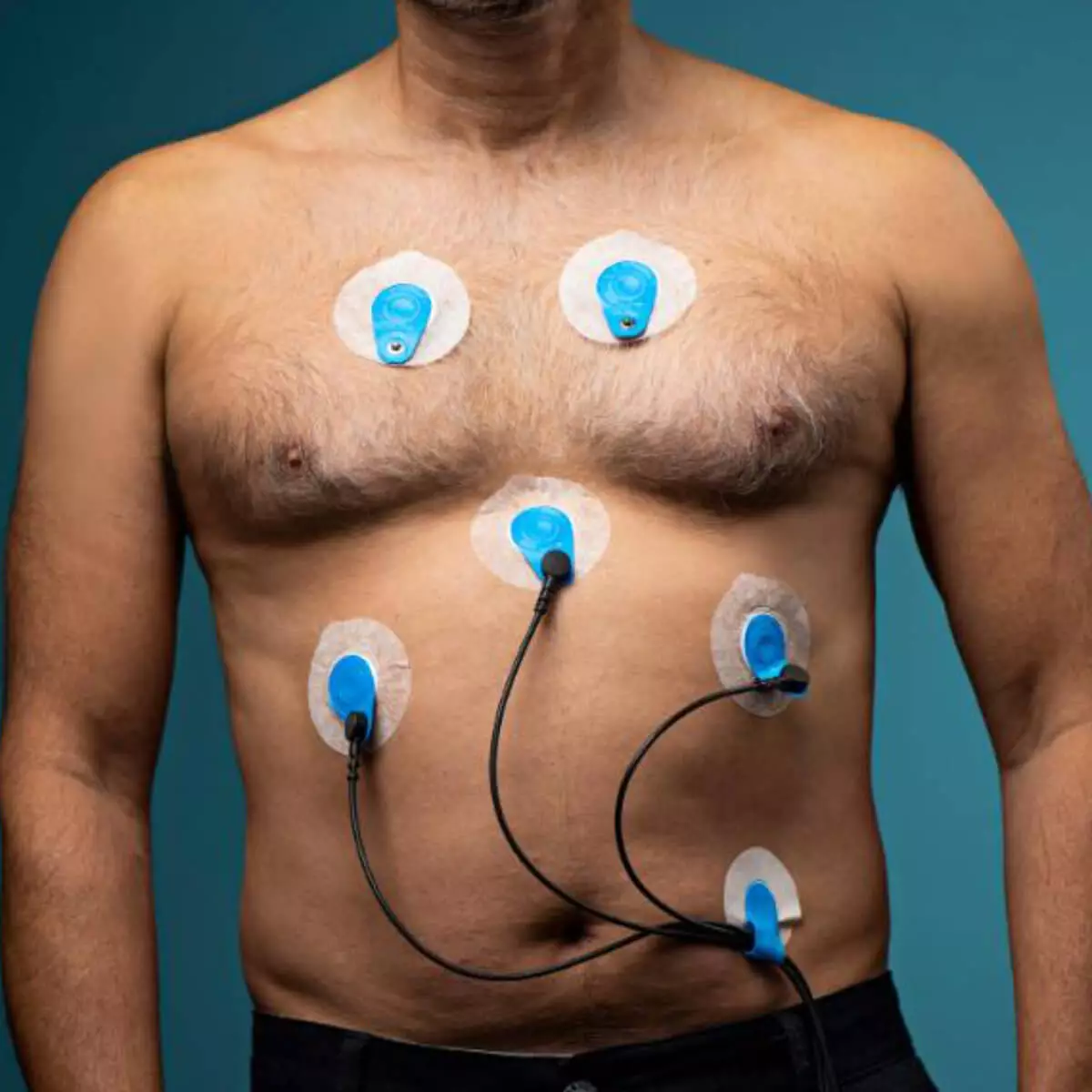  Electrodes à usage unique BlueSensor VL