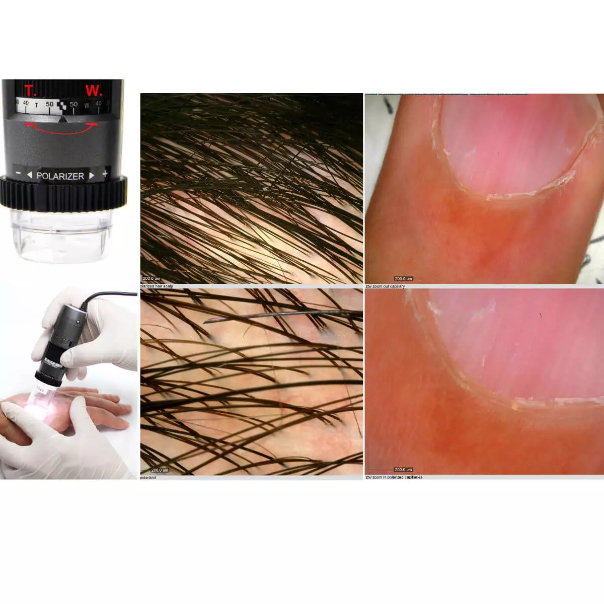  Dermatoscope vidéo DermaScope Polarizer HR 200x